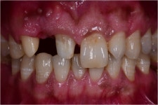 동그라미치과기공소