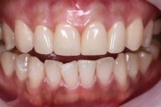 동그라미치과기공소