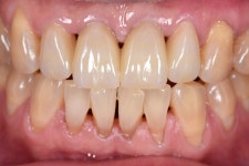 동그라미치과기공소