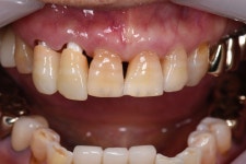 동그라미치과기공소