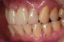 동그라미치과기공소