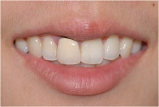 동그라미치과기공소