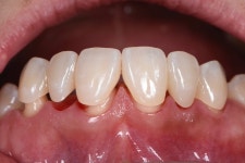 동그라미치과기공소