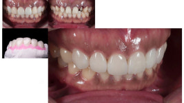 라라치과기공소