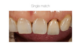 라라치과기공소