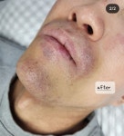 퍼스널뷰티 인 왁싱(in waxing) | 퍼스널뷰티 인 왁싱