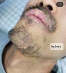 퍼스널뷰티 인 왁싱(in waxing) | 퍼스널뷰티 인 왁싱