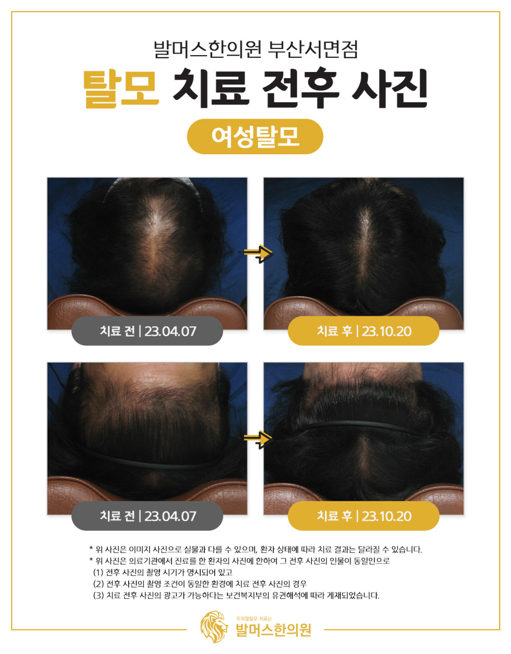 발머스한의원 부산서면