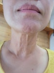 진피부관리실