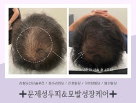 라온하제 두피 탈모케어 눈썹 속눈썹펌 천안본점