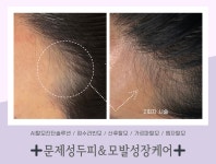 라온하제 두피 탈모케어 눈썹 속눈썹펌 천안본점