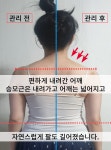 야무진 허리상담소 목어깨허리무릎 체형교정 수원본점