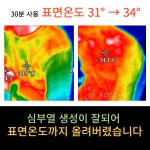 미가의료기 미카페