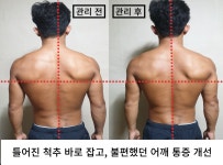 야무진 허리상담소 목어깨허리무릎 체형교정 수원본점