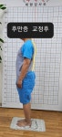 주약손체형교정명가