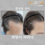 일루젼스칼프 안양