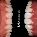 라라치과기공소