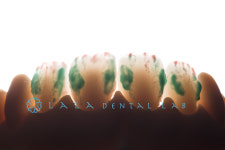 라라치과기공소