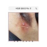 예쁠연 아크네스킨랩 고양일산지축점