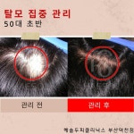 헤솔두피클리닉스 부산덕천점