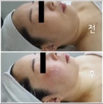 미라클뷰티랩 마곡본점