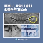 플란트구강악안면외과치과의원