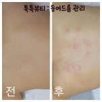 톡톡뷰티 톡톡뷰티센터