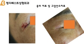 명지베스트성형외과의원