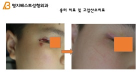 명지베스트성형외과의원