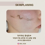 천안왁싱 뷰티앤케이