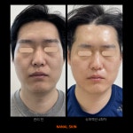 나날스킨 강남본점