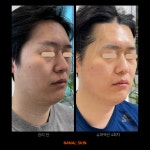 나날스킨 강남본점