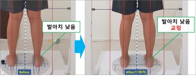바로세움자세교정센터 창원용호동점