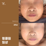 더맑은스킨 시흥신천역점
