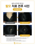 발머스한의원 광주