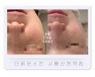 더맑은스킨 시흥신천역점