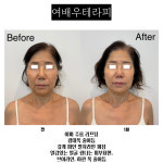 라온제이 에스테틱