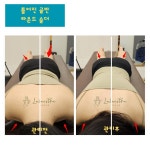 라라에스떼/ 얼굴축소연구소