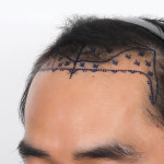 맥스웰피부과의원 강남점