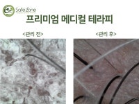 액손알앤디세이프존양산센타 | 세이프존 액손알앤디
