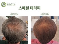 액손알앤디세이프존양산센타 | 세이프존 액손알앤디