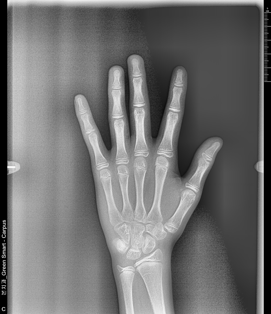 본치과의원 광고