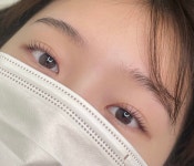 요니네일