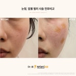 닥터셈매직뷰티의원 부산서면