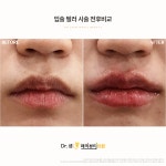 닥터셈매직뷰티의원 부산서면