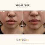 닥터셈매직뷰티의원 부산서면