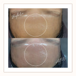 DK스킨두피센터 부천점