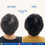 헤드샷스칼프제나 | 헤드샷스칼프제이닷