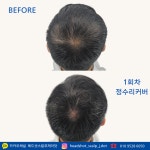 헤드샷스칼프제나 | 헤드샷스칼프제이닷