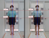 엠에스알운동재활 동탄점